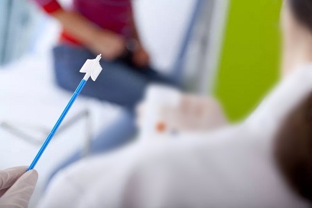 Pokroky v screeningu rakoviny děložního čípku: Role testů HPV se sestavováním