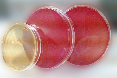 Salmonella Shigella Agar (SS): Základní médium pro izolaci patogenu