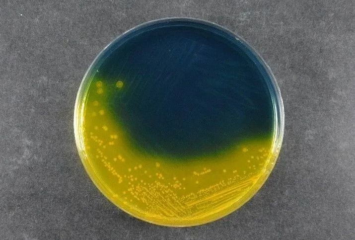 Zajištění bezpečnosti potravin: Babio's Salmonella Shigella Agar (SS) podporuje globální standardy detekce patogenů
