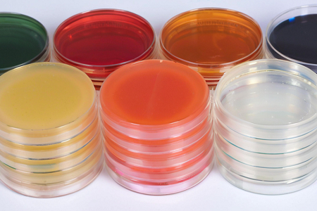 Triple Sugar Iron Agar (TSI): Přesná diferenciace enterických bacil s Babiem