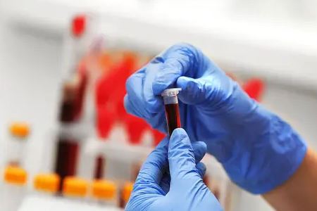 Rychlá detekce malárie: Testovací souprava BABIO Dual Antigen podporuje globální zdraví