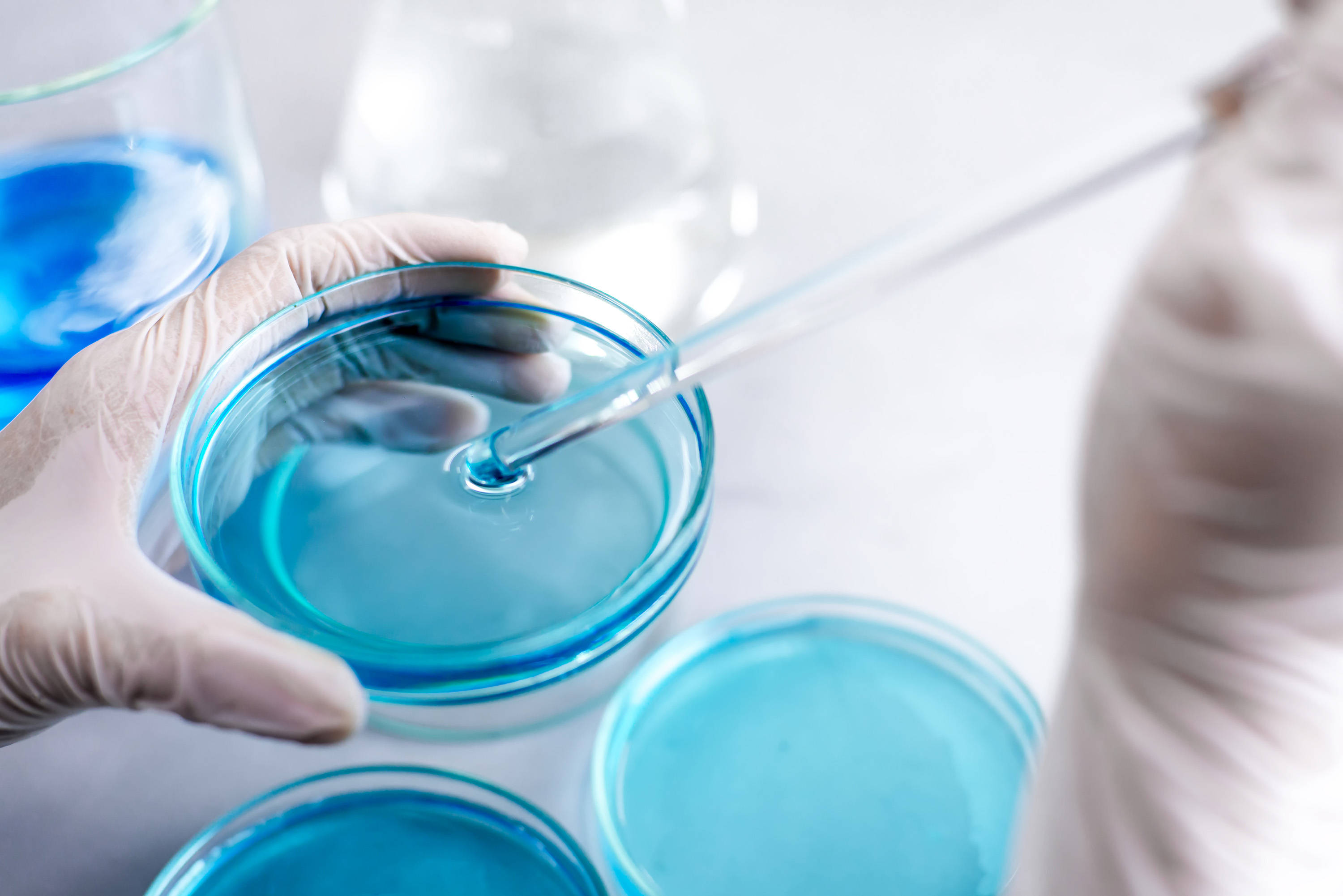 BABIO představuje spolehlivé médium SDA pro detekci plísní