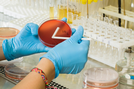 BABIO MacConkey Agar Medium – prémiová selektivní izolace pro globální mikrobiologickou diagnostiku